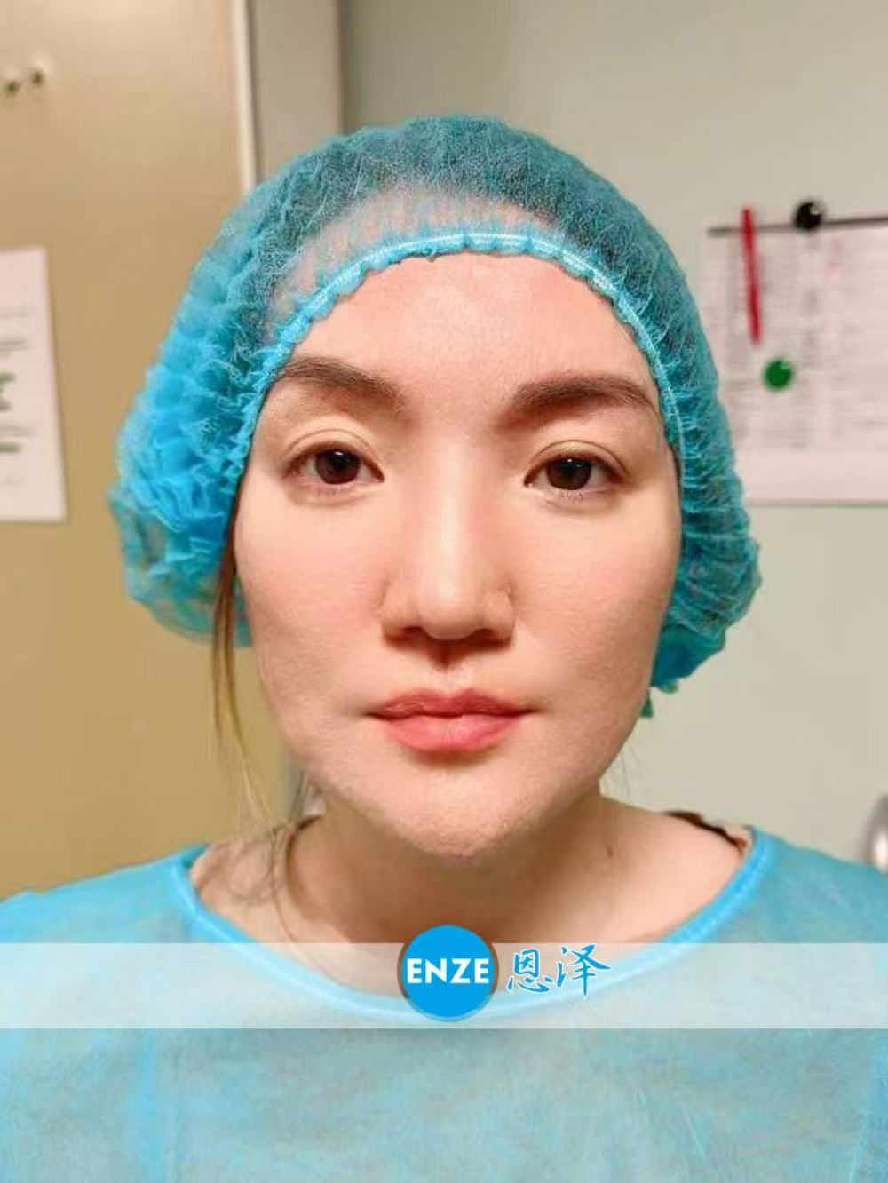格鲁吉亚试管婴儿助孕爱心使者着床成功