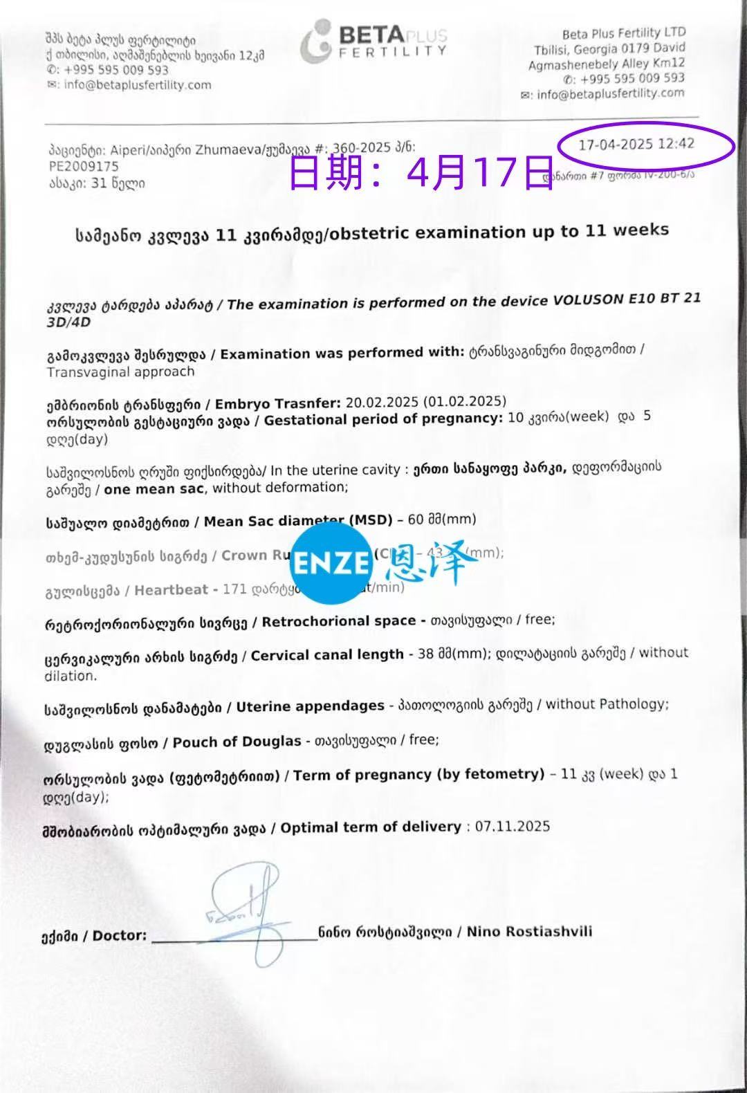 格鲁吉亚试管婴儿助孕爱心使者10周产检顺利过关