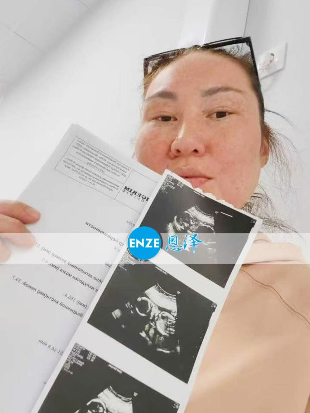格鲁吉亚试管婴儿助孕爱心使者20周产检顺利通过