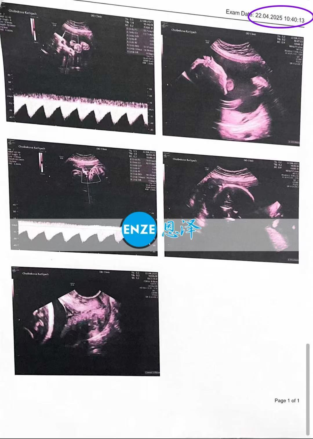 格鲁吉亚试管婴儿助孕爱心使者28周产检顺利通过