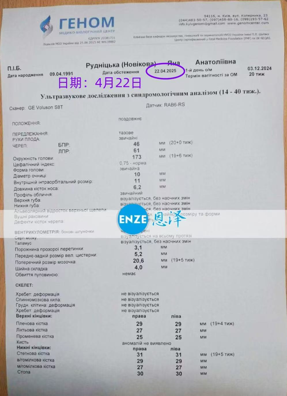 乌克兰试管婴儿助孕爱心使者19周产检顺利通过