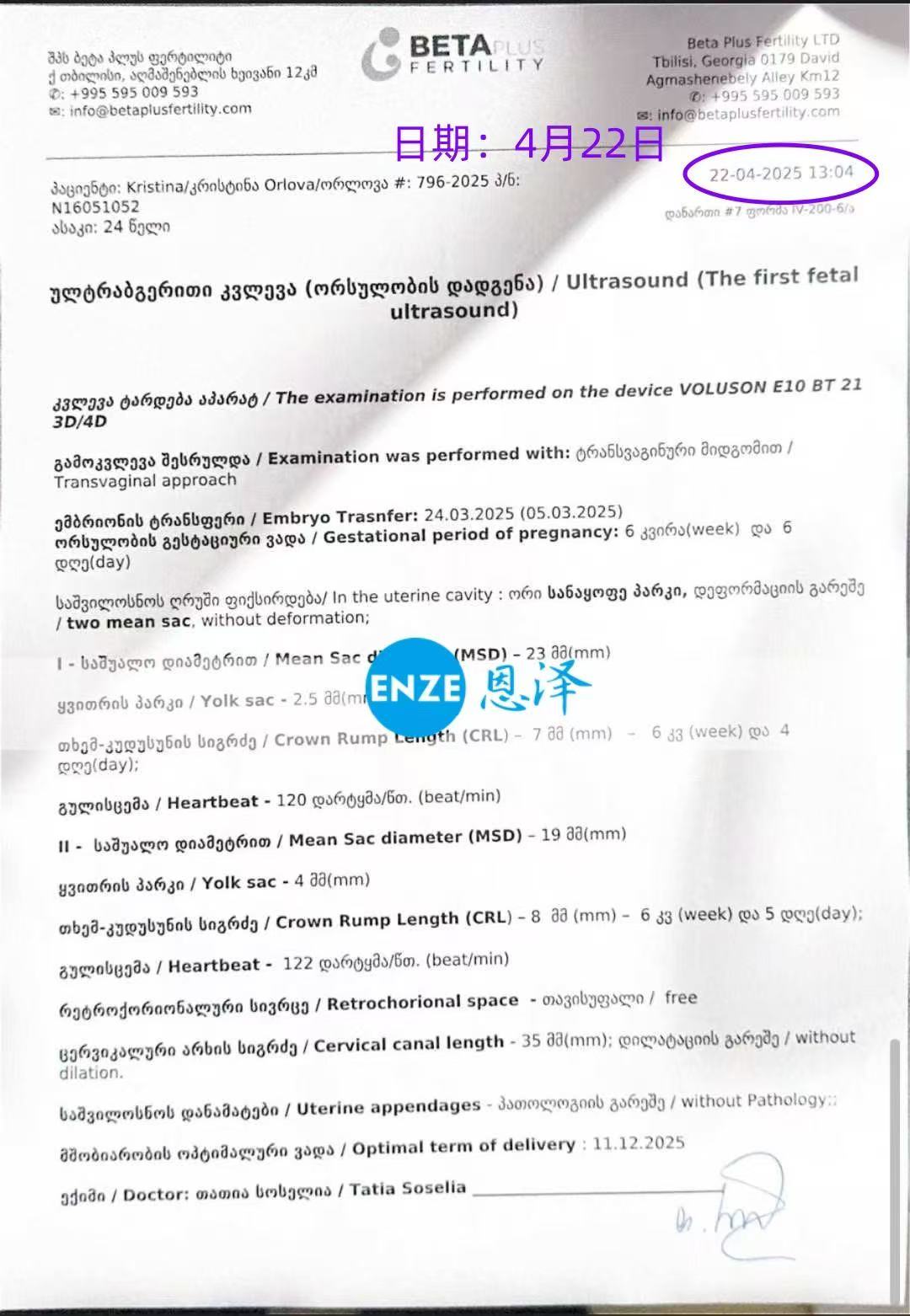 格鲁吉亚试管婴儿助孕爱心使者首检确认双胎报到