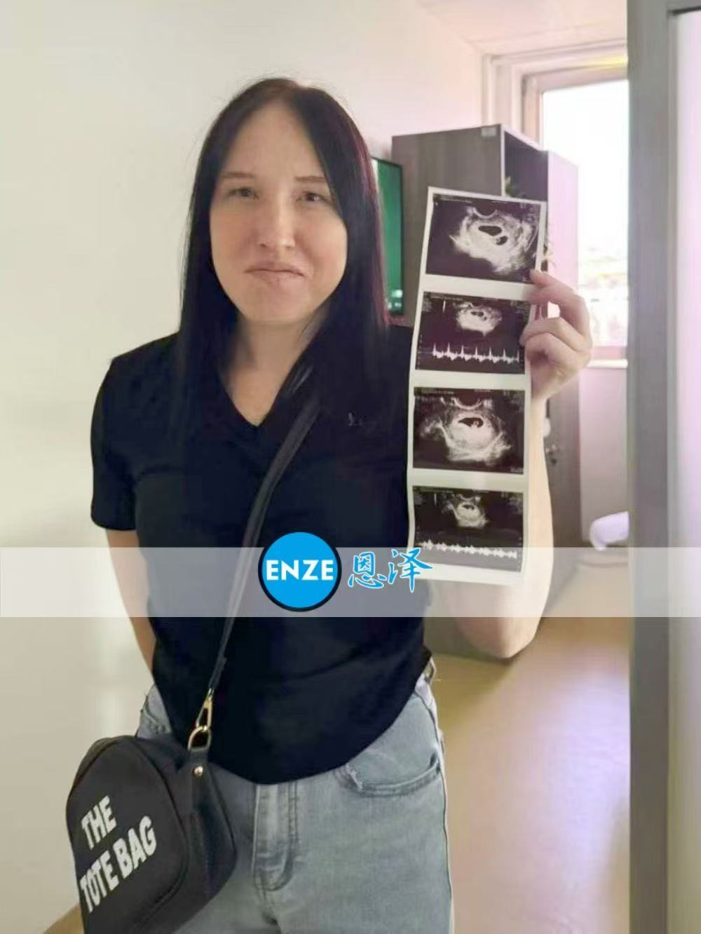 格鲁吉亚试管婴儿助孕爱心使者首检确认双胎报到