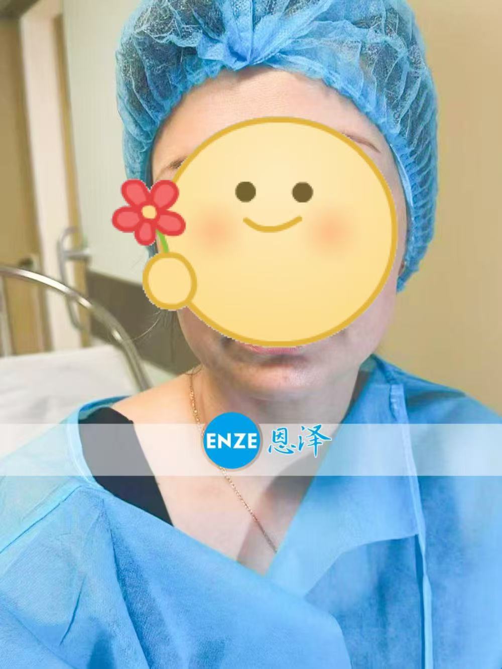 格鲁吉亚试管婴儿助孕爱心使者成功完成移植
