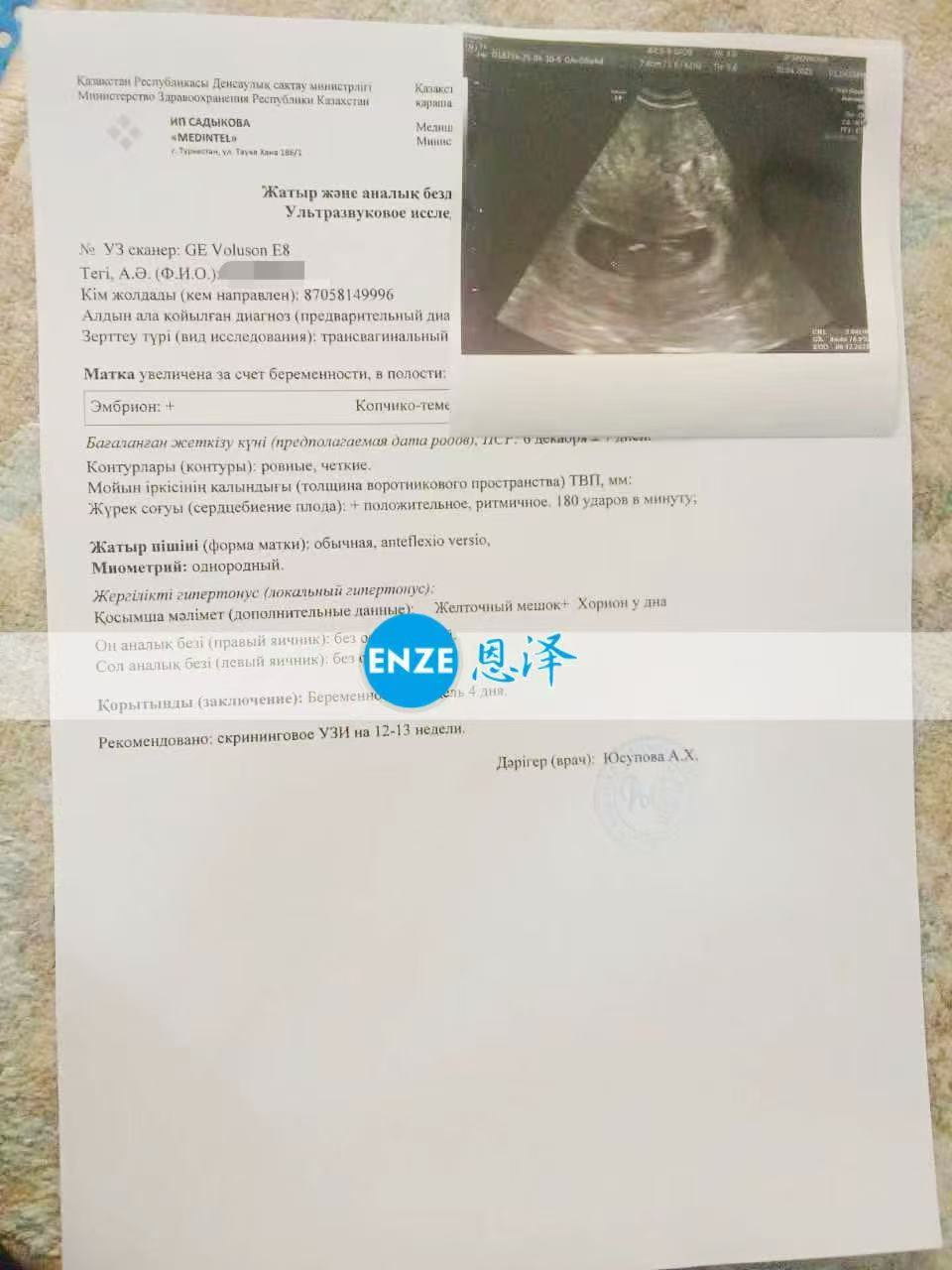 格鲁吉亚试管婴儿助孕爱心使者8周产检顺利过关
