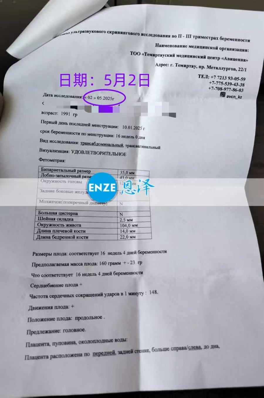 格鲁吉亚试管婴儿助孕爱心使者16周产检顺利通过