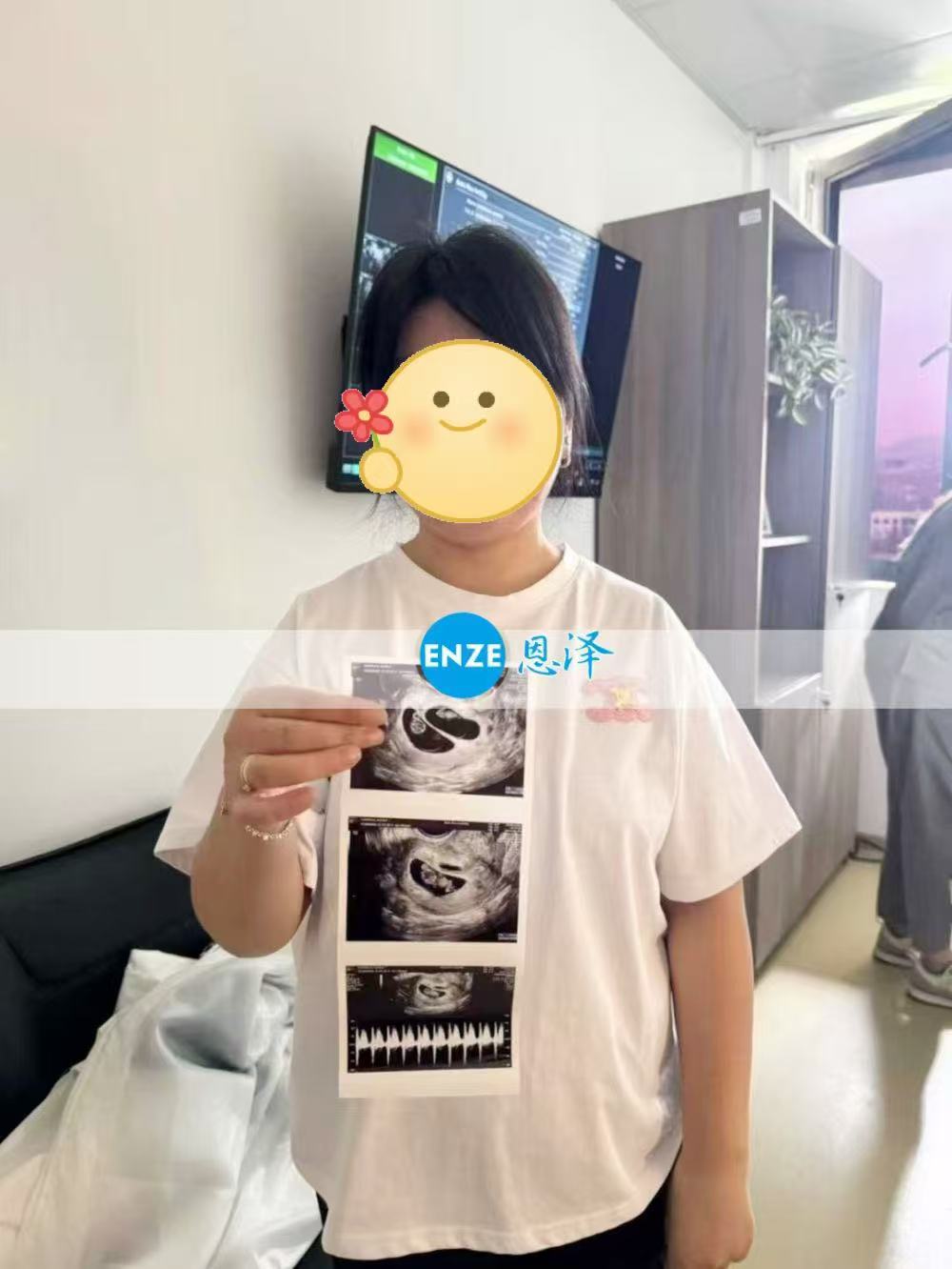 格鲁吉亚试管婴儿助孕爱心使者9周产检顺利过关