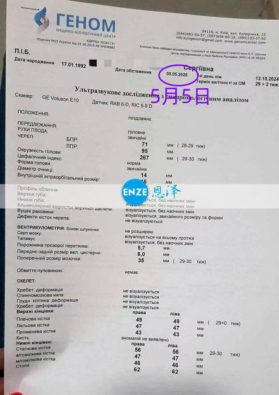 乌克兰试管婴儿助孕爱心使者28周检查顺利过关