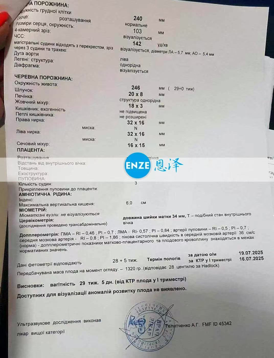 乌克兰试管婴儿助孕爱心使者28周检查顺利过关