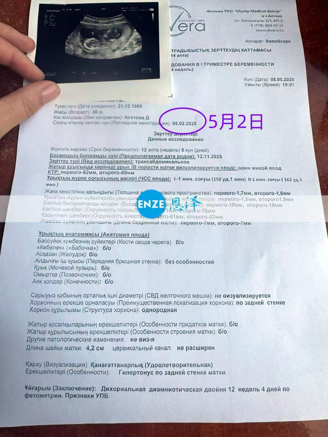格鲁吉亚试管婴儿助孕爱心使者正式度过风险期