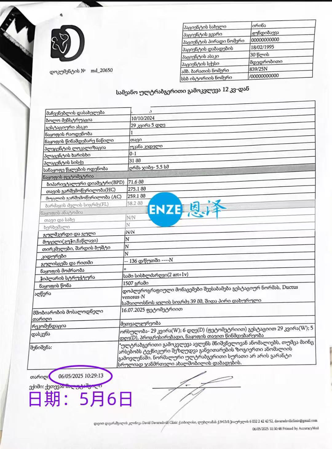 格鲁吉亚试管婴儿助孕爱心使者29周产检顺利过关