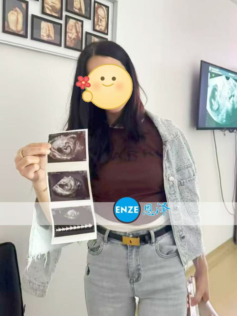 格鲁吉亚试管婴儿助孕爱心使者10周产检顺利通过