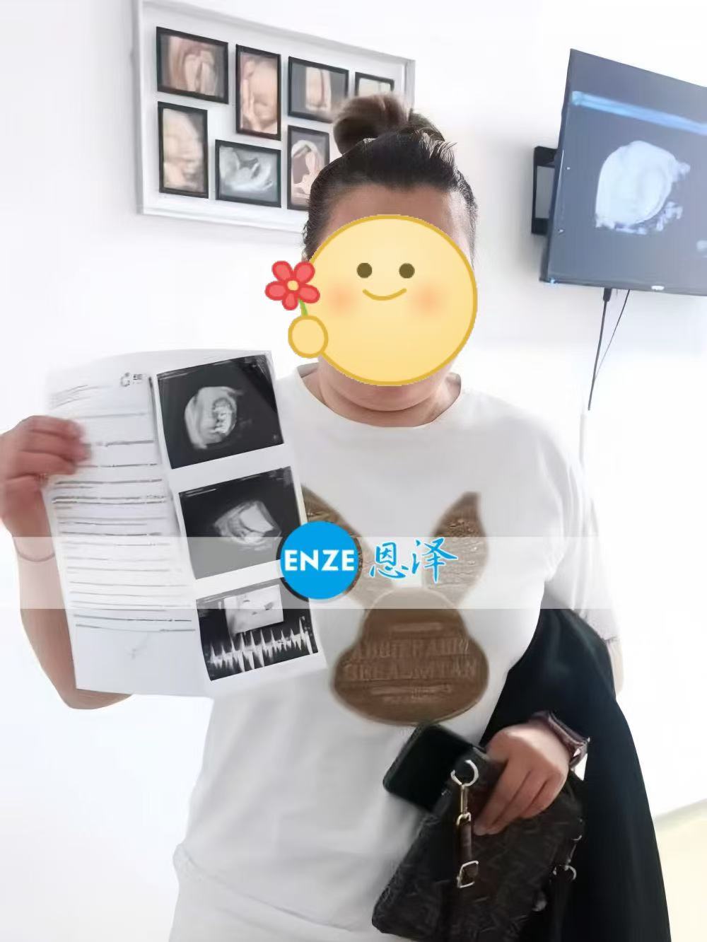 格鲁吉亚试管婴儿助孕爱心使者10周产检顺利通过