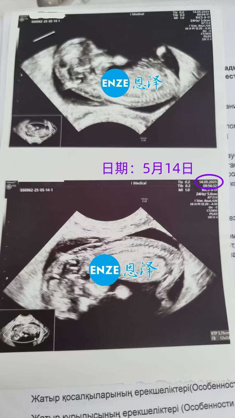 格鲁吉亚试管婴儿助孕爱心使者正式进入稳定期