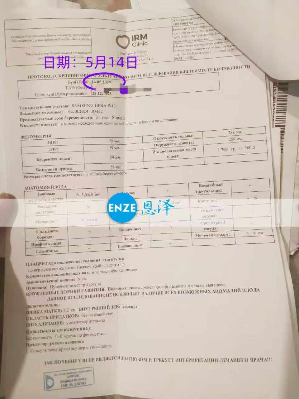 哈萨克斯坦试管婴儿助孕爱心使者31周产检顺利通过