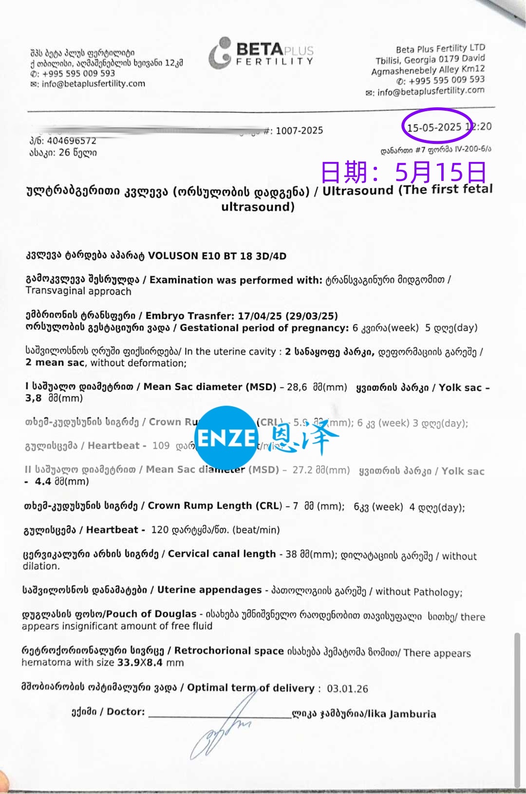 恩泽格鲁吉亚试管婴儿助孕爱心使者6周检查顺利通过