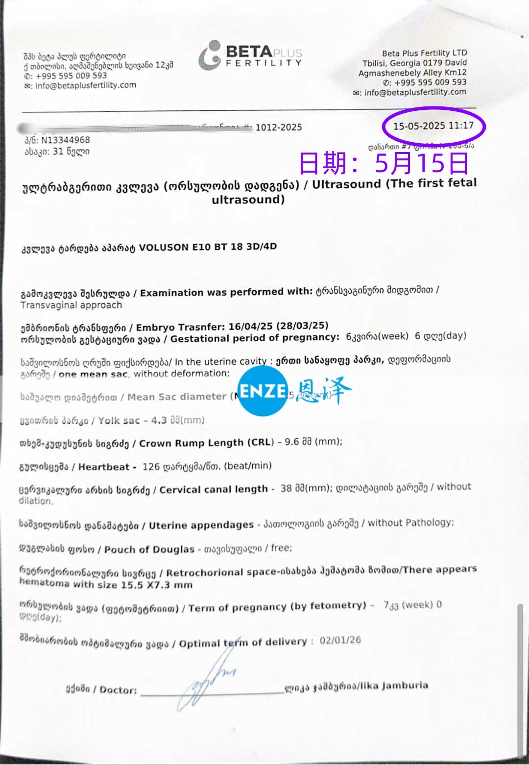 恩泽格鲁吉亚试管婴儿助孕爱心使者7周检查顺利通过