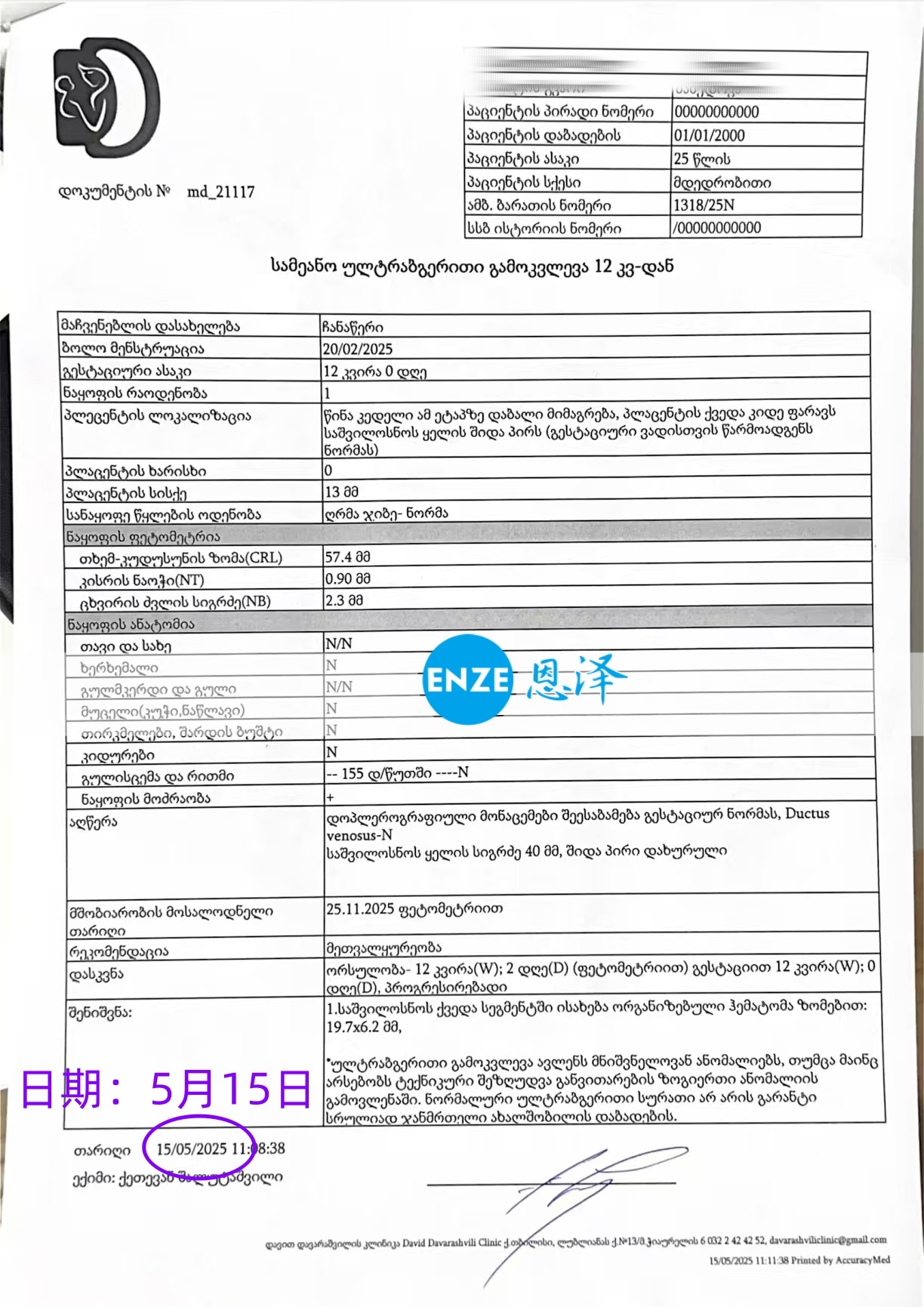 恩泽格鲁吉亚试管婴儿助孕爱心使者12周检查顺利通过