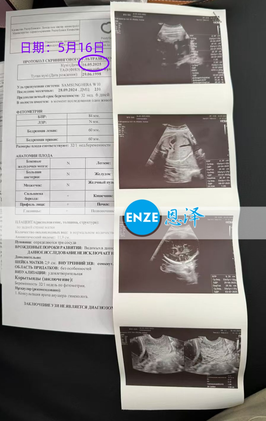 恩泽格鲁吉亚试管婴儿助孕爱心使者32周检查顺利通过