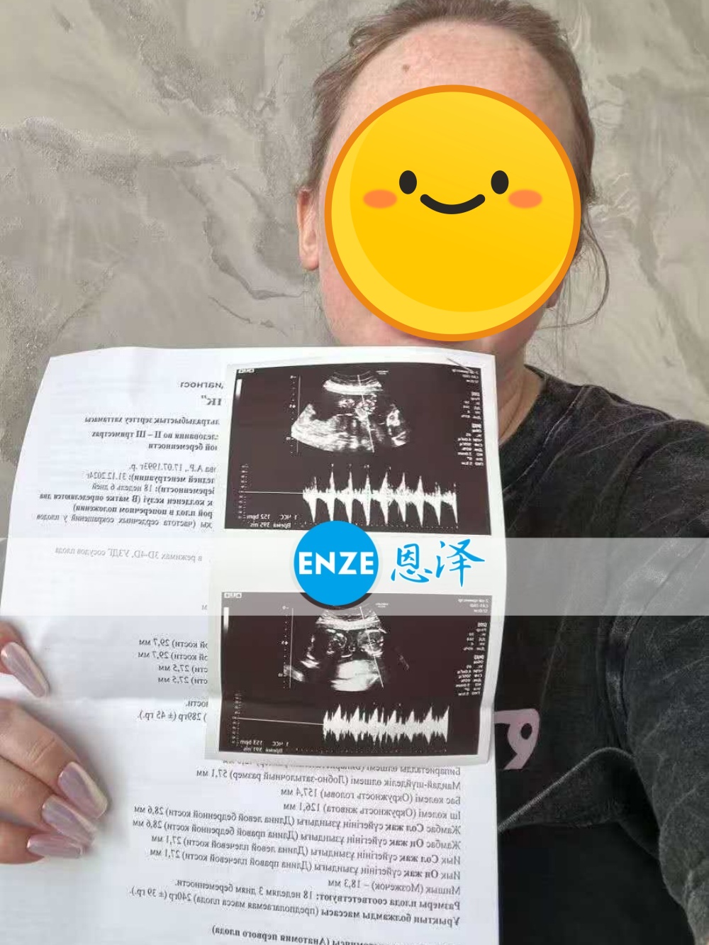 恩泽格鲁吉亚试管婴儿助孕爱心使者18周检查顺利通过