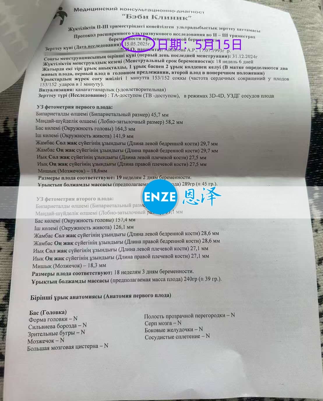 恩泽格鲁吉亚试管婴儿助孕爱心使者18周检查顺利通过