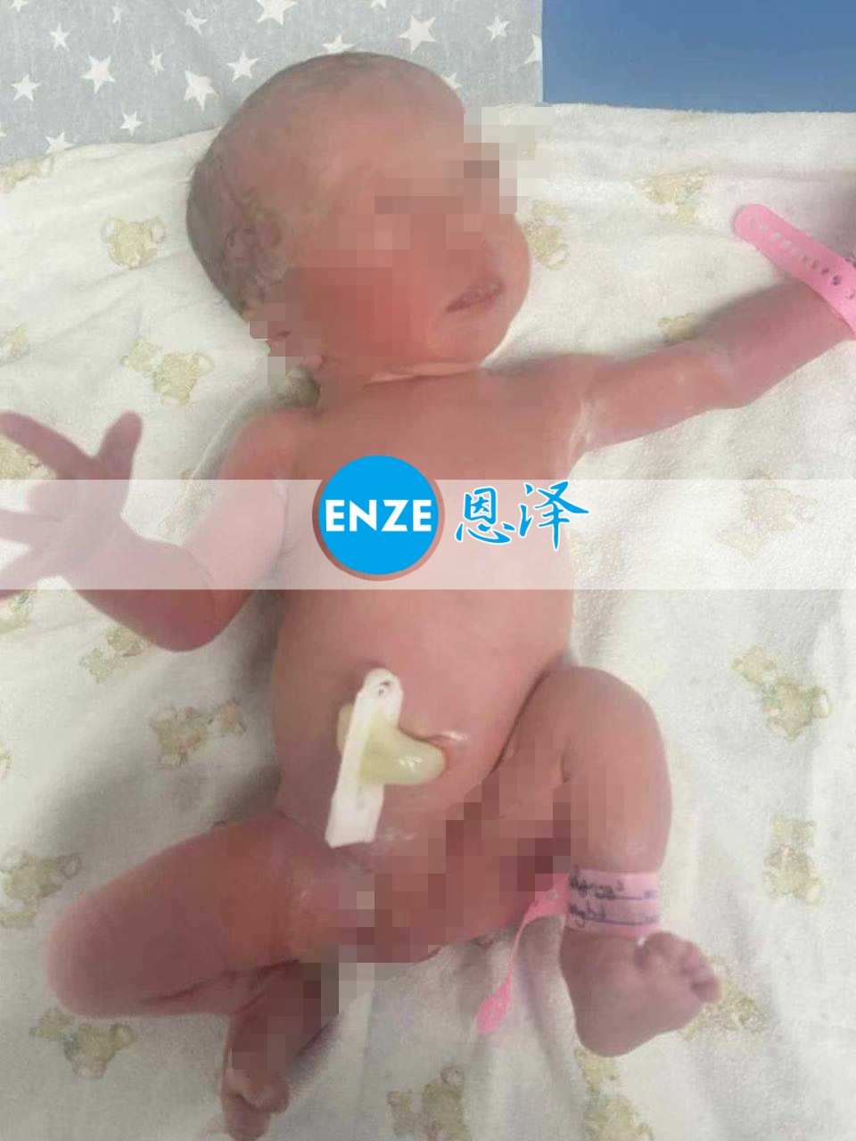 恩泽格鲁吉亚试管婴儿助孕宝宝顺利出生