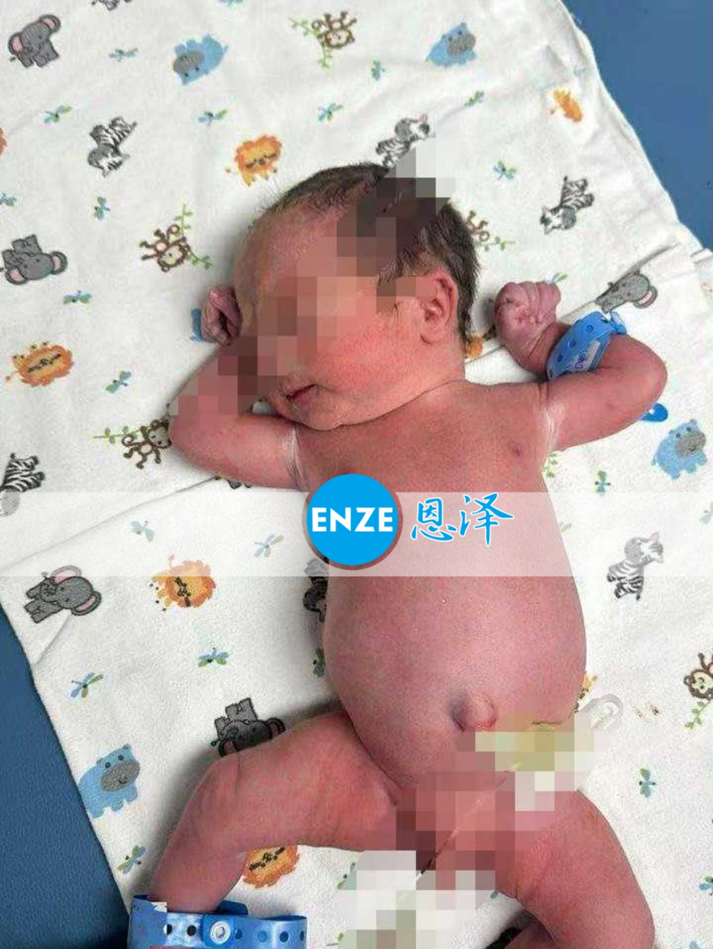 恩泽格鲁吉亚试管婴儿助孕宝宝顺利出生