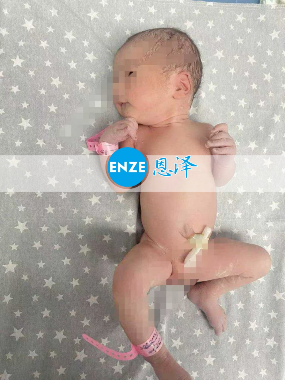 恩泽格鲁吉亚试管婴儿助孕宝宝顺利出生