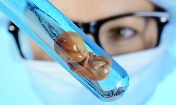 格鲁吉亚做试管婴儿准备需要提前吃叶酸吗？