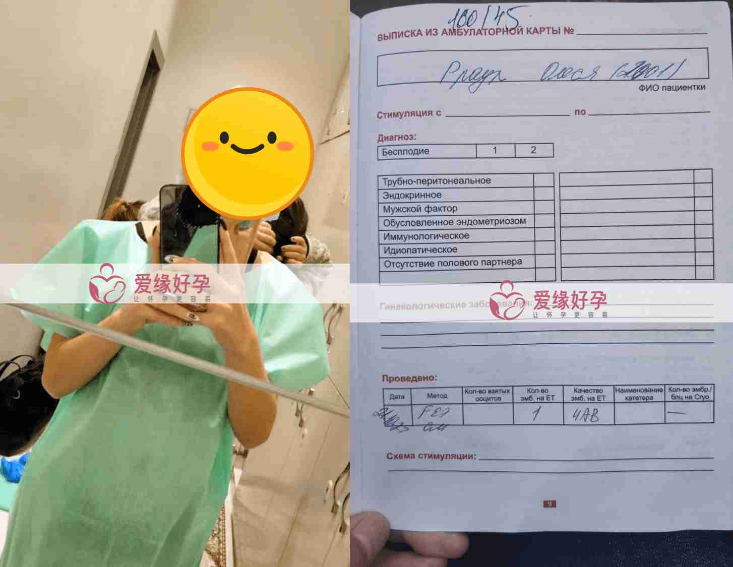 哈萨克斯坦试管婴儿助孕移植一次成功