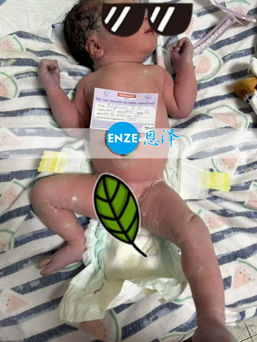 恩泽乌克兰试管婴儿助孕宝宝顺利出生