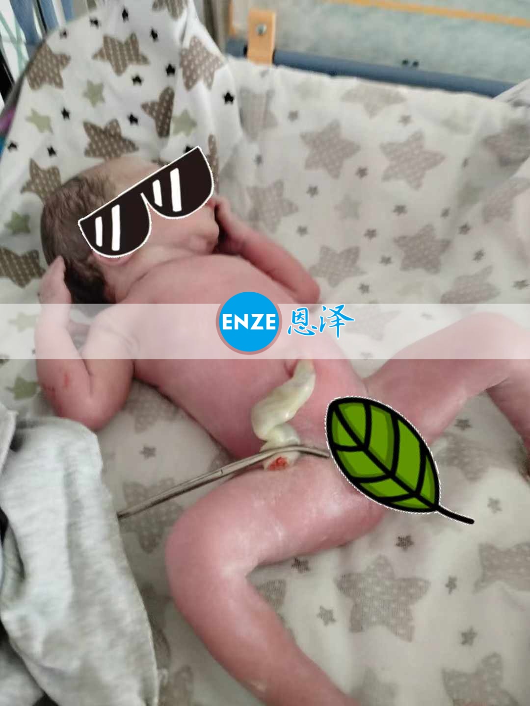 恩泽乌克兰试管婴儿助孕宝宝顺利出生