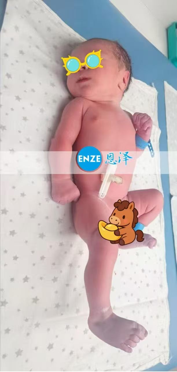 恩泽格鲁吉亚试管婴儿助孕宝宝顺利出生
